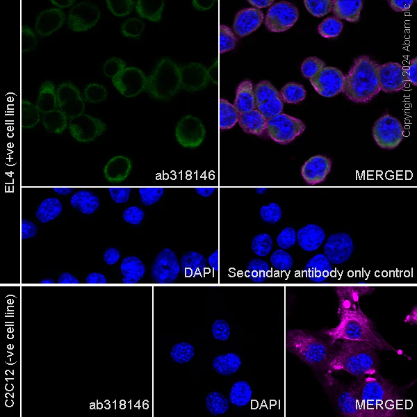 Immunocytochemistry/ Immunofluorescence - Anti-CD3D+CD3G+CD3 epsilon antibody [RM1128] (AB318146)