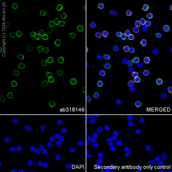 Immunocytochemistry/ Immunofluorescence - Anti-CD3D+CD3G+CD3 epsilon antibody [RM1128] (AB318146)