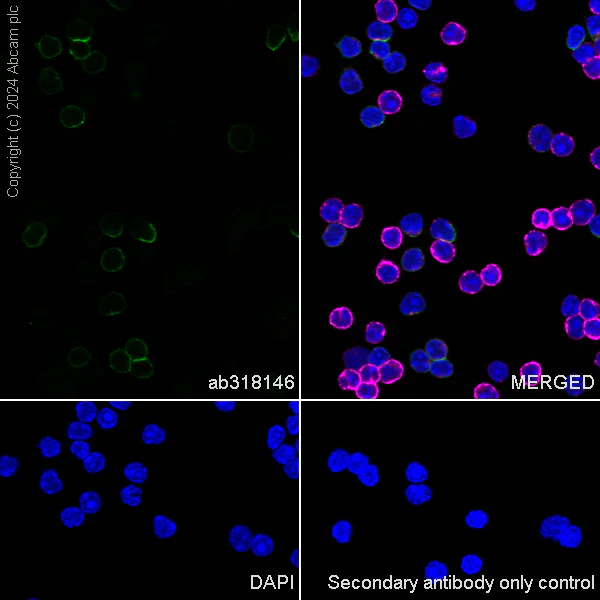 Immunocytochemistry/ Immunofluorescence - Anti-CD3D+CD3G+CD3 epsilon antibody [RM1128] (AB318146)