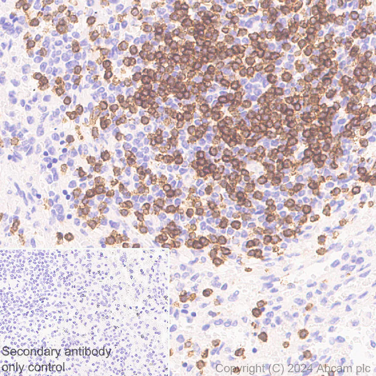 Immunohistochemistry (Formalin/PFA-fixed paraffin-embedded sections) - Anti-CD3D+CD3G+CD3 epsilon antibody [RM1128] (AB318146)