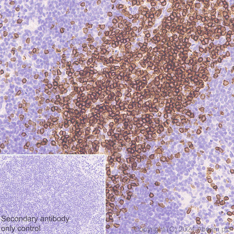 Immunohistochemistry (Formalin/PFA-fixed paraffin-embedded sections) - Anti-CD3D+CD3G+CD3 epsilon antibody [RM1128] (AB318146)
