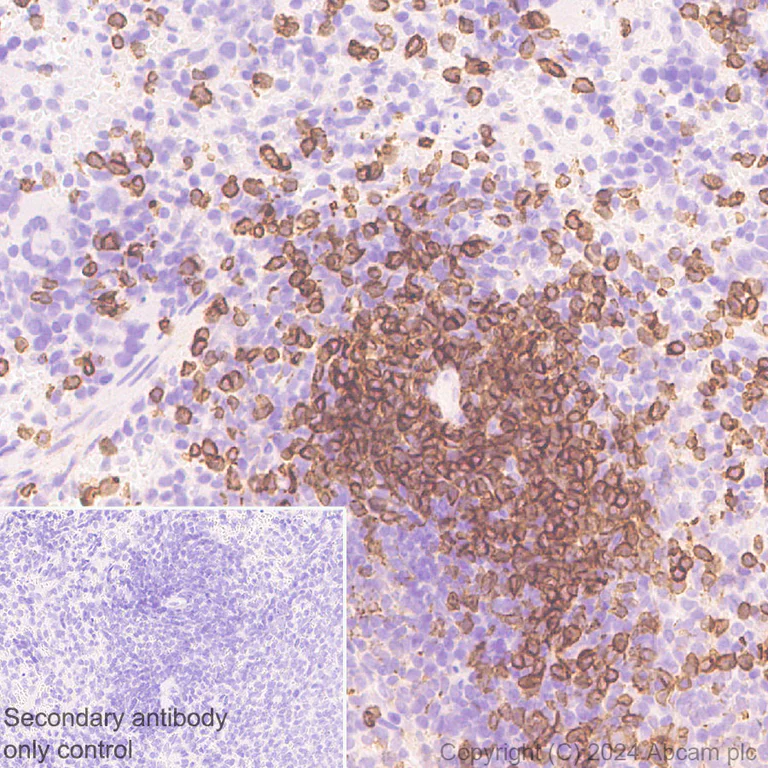 Immunohistochemistry (Formalin/PFA-fixed paraffin-embedded sections) - Anti-CD3D+CD3G+CD3 epsilon antibody [RM1128] (AB318146)