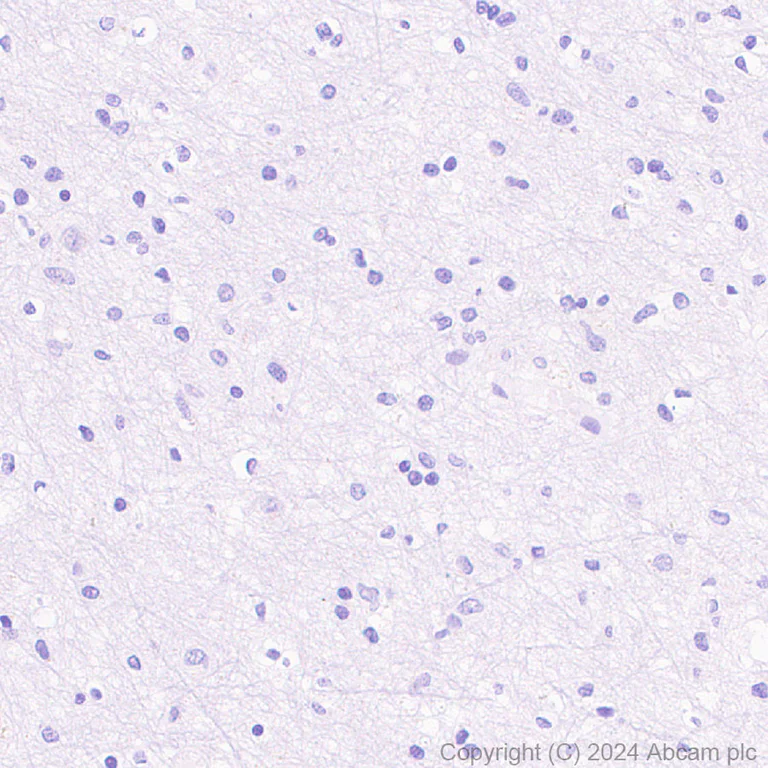 Immunohistochemistry (Formalin/PFA-fixed paraffin-embedded sections) - Anti-CD3D+CD3G+CD3 epsilon antibody [RM1128] (AB318146)