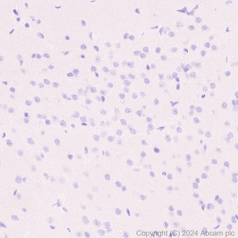 Immunohistochemistry (Formalin/PFA-fixed paraffin-embedded sections) - Anti-CD3D+CD3G+CD3 epsilon antibody [RM1128] (AB318146)