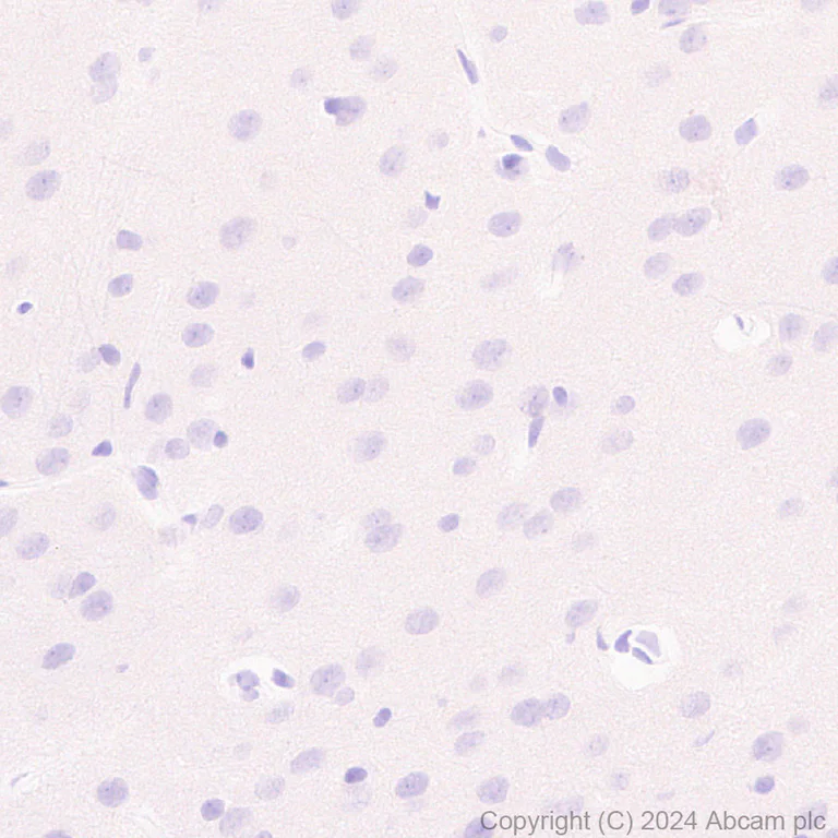 Immunohistochemistry (Formalin/PFA-fixed paraffin-embedded sections) - Anti-CD3D+CD3G+CD3 epsilon antibody [RM1128] (AB318146)