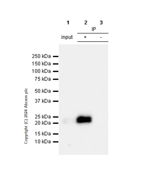 Immunoprecipitation - Anti-CD3D+CD3G+CD3 epsilon antibody [RM1128] (AB318146)