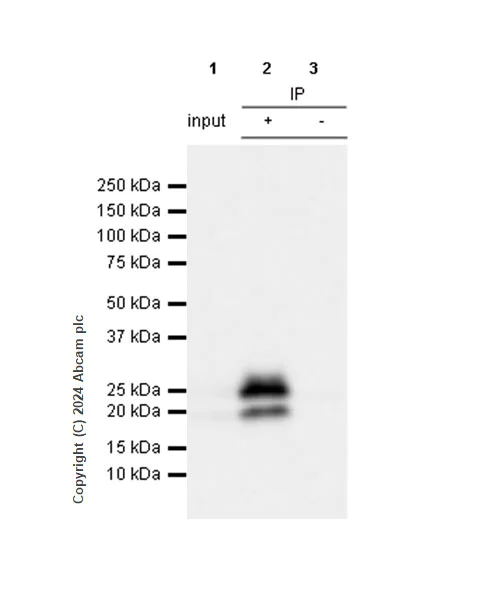 Immunoprecipitation - Anti-CD3D+CD3G+CD3 epsilon antibody [RM1128] (AB318146)