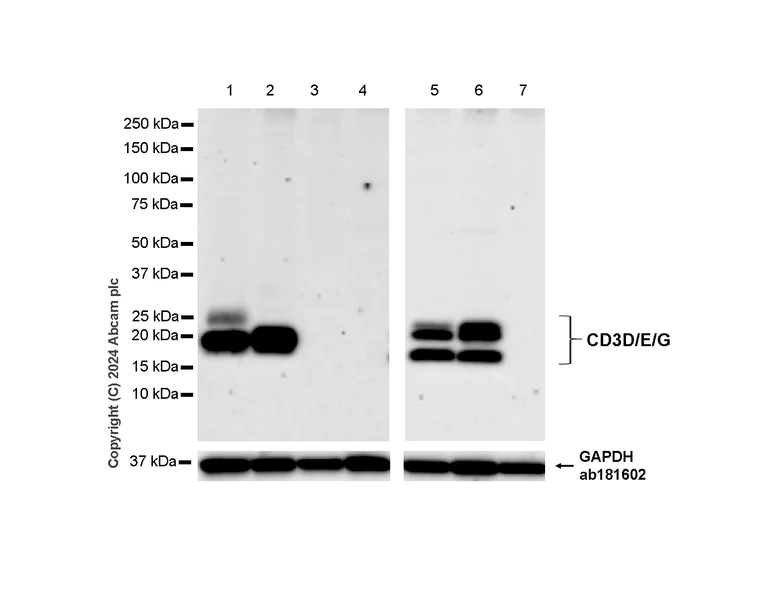 Western blot - Anti-CD3D+CD3G+CD3 epsilon antibody [RM1128] (AB318146)