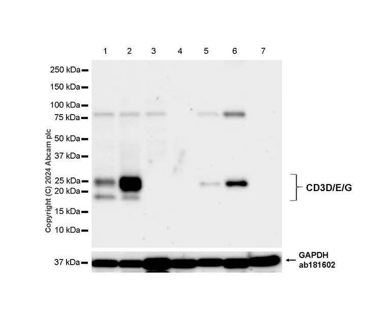 Western blot - Anti-CD3D+CD3G+CD3 epsilon antibody [RM1128] (AB318146)