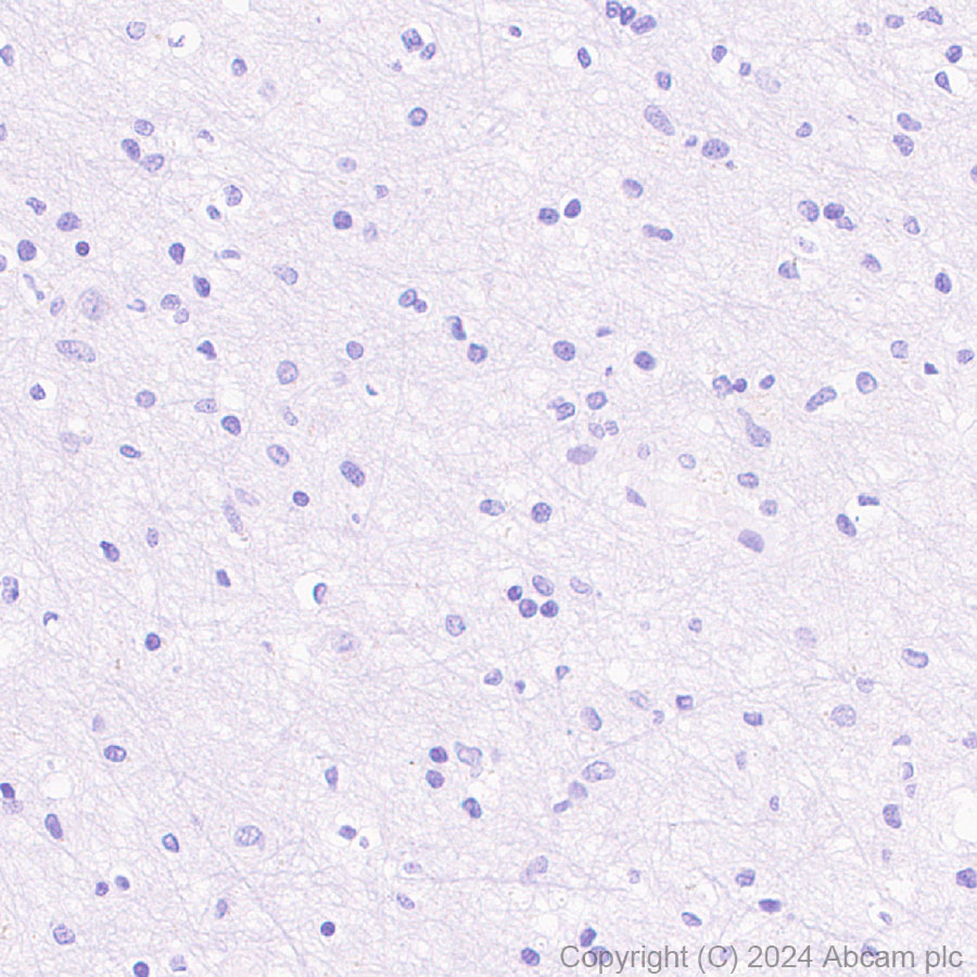 Immunohistochemistry (Formalin/PFA-fixed paraffin-embedded sections) - Anti-CD3D+CD3G+CD3 epsilon antibody [RM1128] - BSA and Azide free (AB318147)