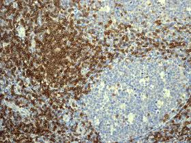 Immunohistochemistry (Formalin/PFA-fixed paraffin-embedded sections) - Anti-CD3G antibody [EPR4516] (AB108996)