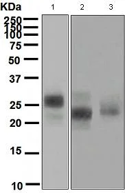 Western blot - Anti-CD3G antibody [EPR4516] - BSA and Azide free (AB247738)