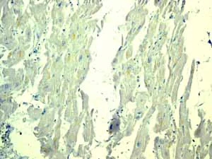 Immunohistochemistry (Formalin/PFA-fixed paraffin-embedded sections) - Anti-CD3G antibody [EPR4517] (AB134096)