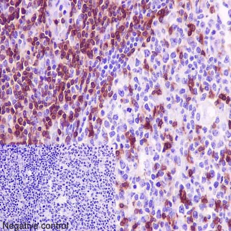 Immunohistochemistry (Formalin/PFA-fixed paraffin-embedded sections) - Anti-CD3G antibody [EPR4517] (AB134096)