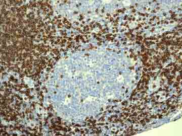Immunohistochemistry (Formalin/PFA-fixed paraffin-embedded sections) - Anti-CD3G antibody [EPR4517] (AB134096)