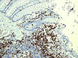 Anti-CD3G antibody [EPR4517] (ab134096) | Abcam