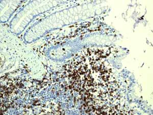 Immunohistochemistry (Formalin/PFA-fixed paraffin-embedded sections) - Anti-CD3G antibody [EPR4517] (AB134096)