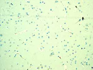 Immunohistochemistry (Formalin/PFA-fixed paraffin-embedded sections) - Anti-CD3G antibody [EPR4517] - BSA and Azide free (AB229282)