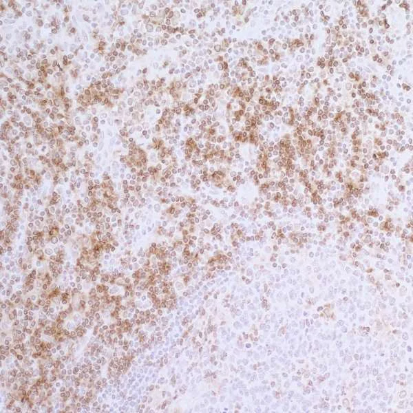 Immunohistochemistry (Formalin/PFA-fixed paraffin-embedded sections) - Anti-CD4 antibody [BL-155-1C11] - BSA free (AB243872)