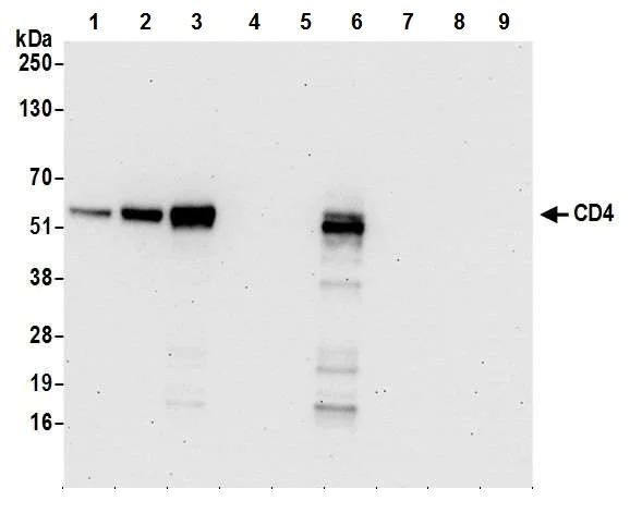 Western blot - Anti-CD4 antibody [BL-155-1C11] - BSA free (AB243872)