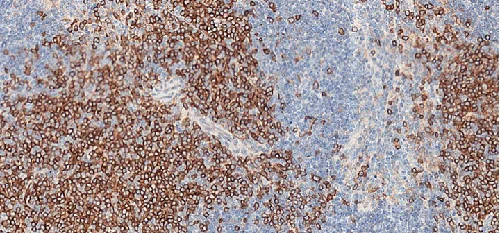 Immunohistochemistry (Formalin/PFA-fixed paraffin-embedded sections) - Anti-CD4 antibody [CAL4] (AB237722)