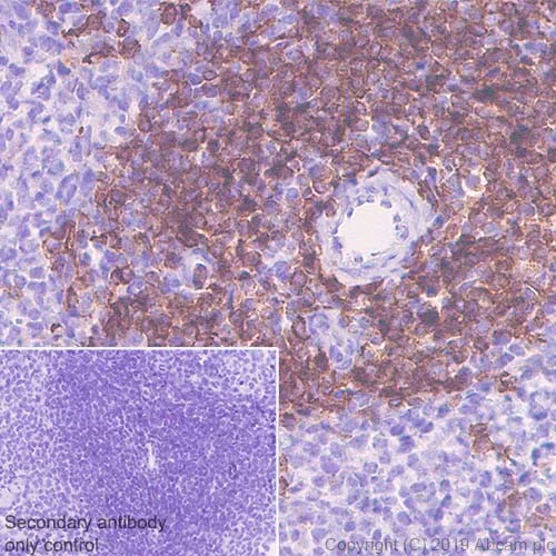 Immunohistochemistry (Formalin/PFA-fixed paraffin-embedded sections) - Anti-CD4 antibody [CAL4] (AB237722)