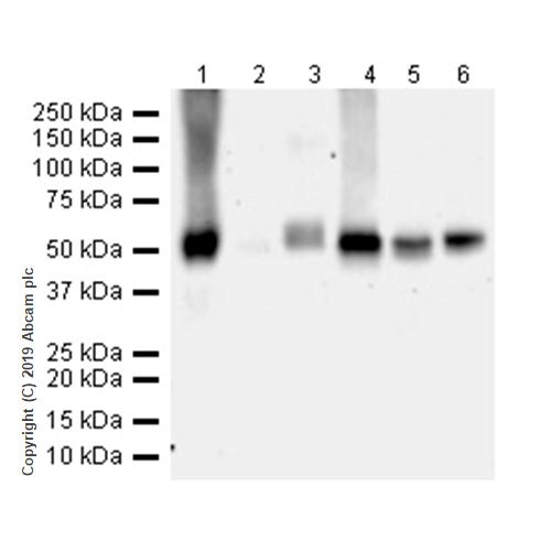 Western blot - Anti-CD4 antibody [CAL4] (AB237722), expandable thumbnail