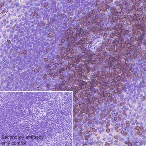 Immunohistochemistry (Formalin/PFA-fixed paraffin-embedded sections) - Anti-CD4 antibody [CAL4] - BSA and Azide free (AB251608)
