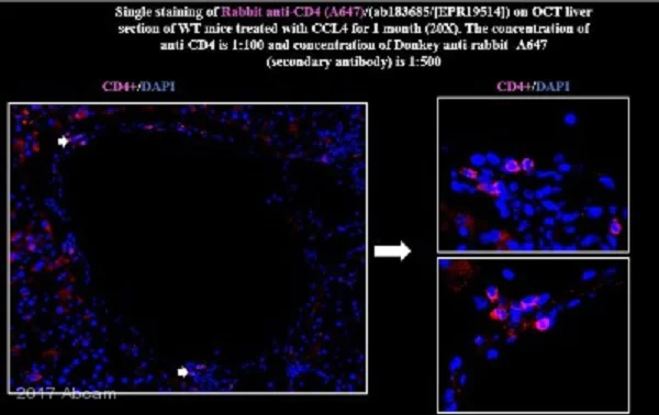 Immunohistochemistry (Frozen sections) - Anti-CD4 antibody [EPR19514] (AB183685)