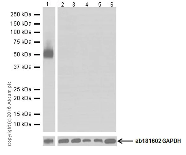 Western blot - Anti-CD4 antibody [EPR19514] (AB183685)