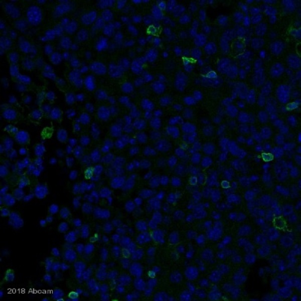 Immunohistochemistry (Formalin/PFA-fixed paraffin-embedded sections) - Anti-CD4 antibody [EPR19514] - BSA and Azide free (AB271945), expandable thumbnail