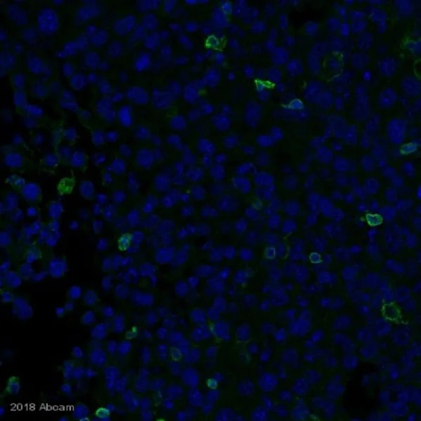 Immunohistochemistry (Formalin/PFA-fixed paraffin-embedded sections) - Anti-CD4 antibody [EPR19514] - BSA and Azide free (AB271945)
