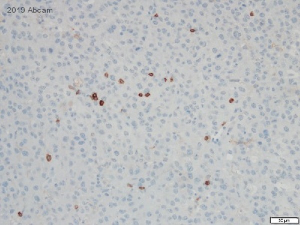 Immunohistochemistry (Formalin/PFA-fixed paraffin-embedded sections) - Anti-CD4 antibody [EPR19514] - BSA and Azide free (ab271945), expandable thumbnail