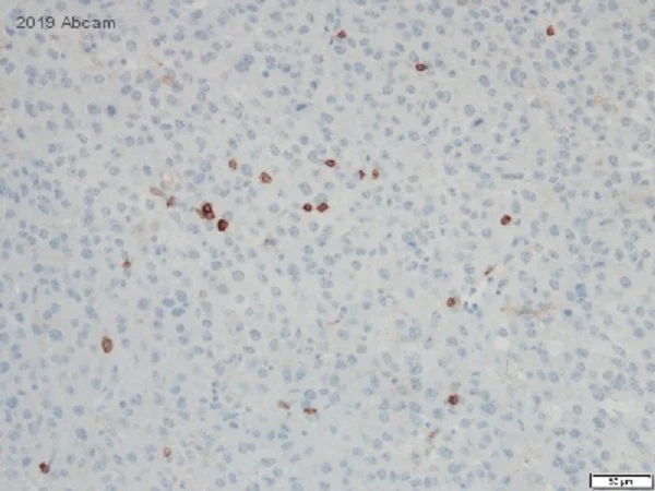 Immunohistochemistry (Formalin/PFA-fixed paraffin-embedded sections) - Anti-CD4 antibody [EPR19514] - BSA and Azide free (AB271945)