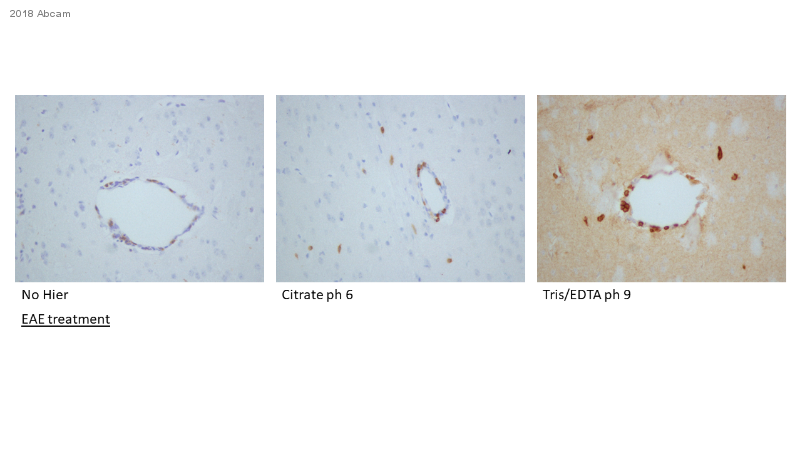 Immunohistochemistry (Formalin/PFA-fixed paraffin-embedded sections) - Anti-CD4 antibody [EPR19514] - BSA and Azide free (ab271945), expandable thumbnail