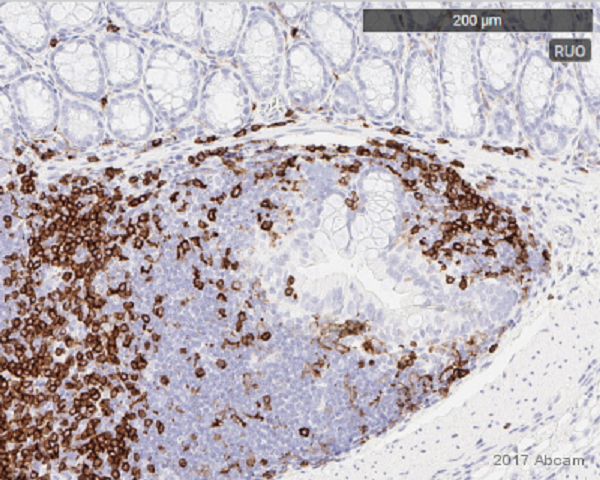 Immunohistochemistry (Formalin/PFA-fixed paraffin-embedded sections) - Anti-CD4 antibody [EPR19514] - BSA and Azide free (AB271945), expandable thumbnail