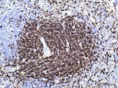 Immunohistochemistry (Formalin/PFA-fixed paraffin-embedded sections) - Anti-CD4 antibody [EPR19514] - BSA and Azide free (ab271945), expandable thumbnail