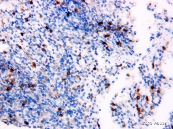 Immunohistochemistry (Formalin/PFA-fixed paraffin-embedded sections) - Anti-CD4 antibody [EPR19514] - BSA and Azide free (AB271945), expandable thumbnail