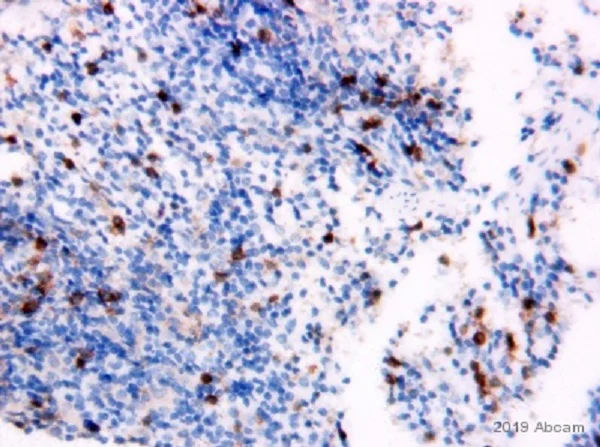 Immunohistochemistry (Formalin/PFA-fixed paraffin-embedded sections) - Anti-CD4 antibody [EPR19514] - BSA and Azide free (AB271945)