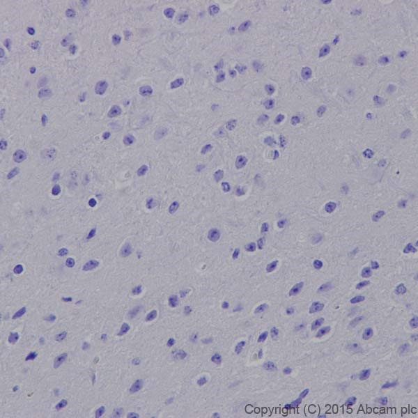 Immunohistochemistry (Formalin/PFA-fixed paraffin-embedded sections) - Anti-CD4 antibody [EPR19514] - BSA and Azide free (ab271945), expandable thumbnail