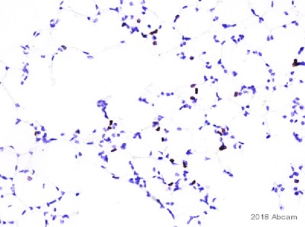 Immunohistochemistry (Formalin/PFA-fixed paraffin-embedded sections) - Anti-CD4 antibody [EPR19514] - BSA and Azide free (ab271945), expandable thumbnail