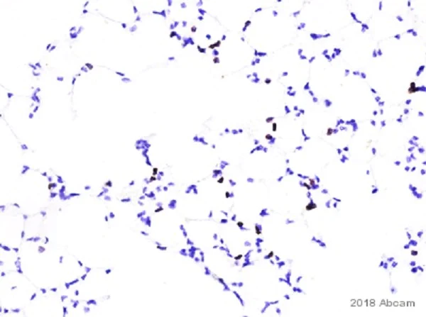 Immunohistochemistry (Formalin/PFA-fixed paraffin-embedded sections) - Anti-CD4 antibody [EPR19514] - BSA and Azide free (AB271945)