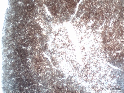 Immunohistochemistry (Formalin/PFA-fixed paraffin-embedded sections) - Anti-CD4 antibody [EPR19514] - BSA and Azide free (ab271945), expandable thumbnail
