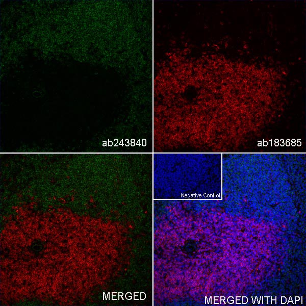 Immunohistochemistry (Frozen sections) - Anti-CD4 antibody [EPR19514] - BSA and Azide free (AB271945), expandable thumbnail