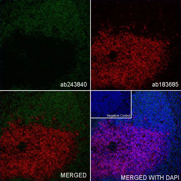 Immunohistochemistry (Frozen sections) - Anti-CD4 antibody [EPR19514] - BSA and Azide free (AB271945)