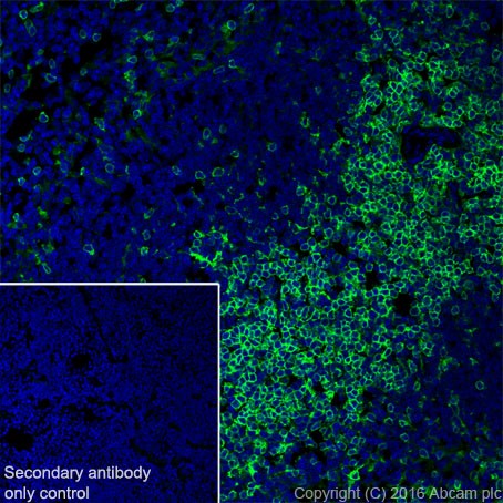 Immunohistochemistry (Frozen sections) - Anti-CD4 antibody [EPR19514] - BSA and Azide free (AB271945), expandable thumbnail