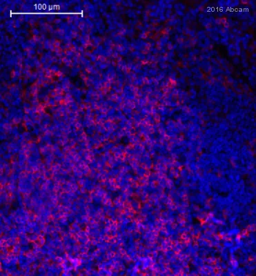Immunohistochemistry (Formalin/PFA-fixed paraffin-embedded sections) - Anti-CD4 antibody [EPR19514] - Low endotoxin, Azide free (AB221775)