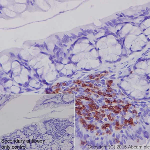Immunohistochemistry (Formalin/PFA-fixed paraffin-embedded sections) - Anti-CD4 antibody [EPR19514] - Low endotoxin, Azide free (AB221775)