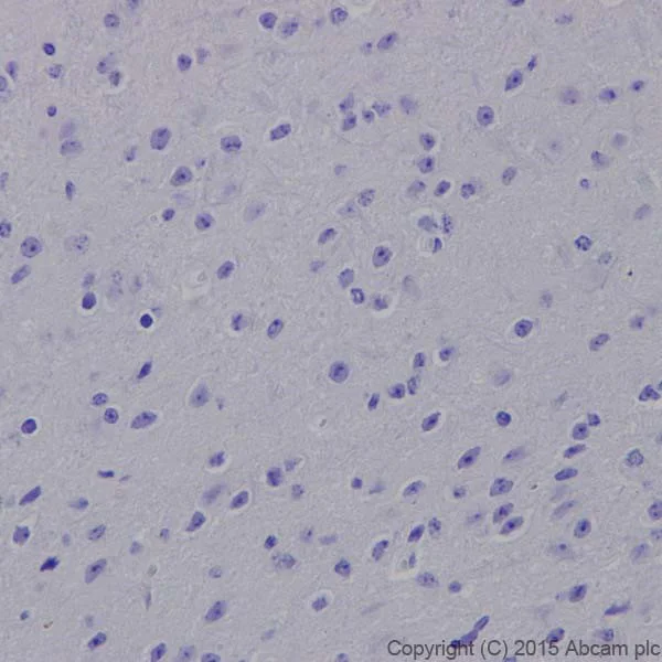 Immunohistochemistry (Formalin/PFA-fixed paraffin-embedded sections) - Anti-CD4 antibody [EPR19514] - Low endotoxin, Azide free (AB221775)