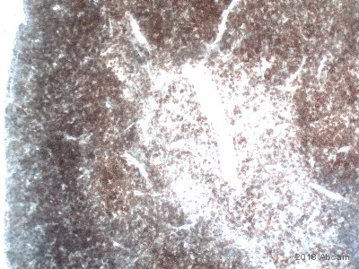 Immunohistochemistry (Formalin/PFA-fixed paraffin-embedded sections) - Anti-CD4 antibody [EPR19514] - Low endotoxin, Azide free (AB221775)